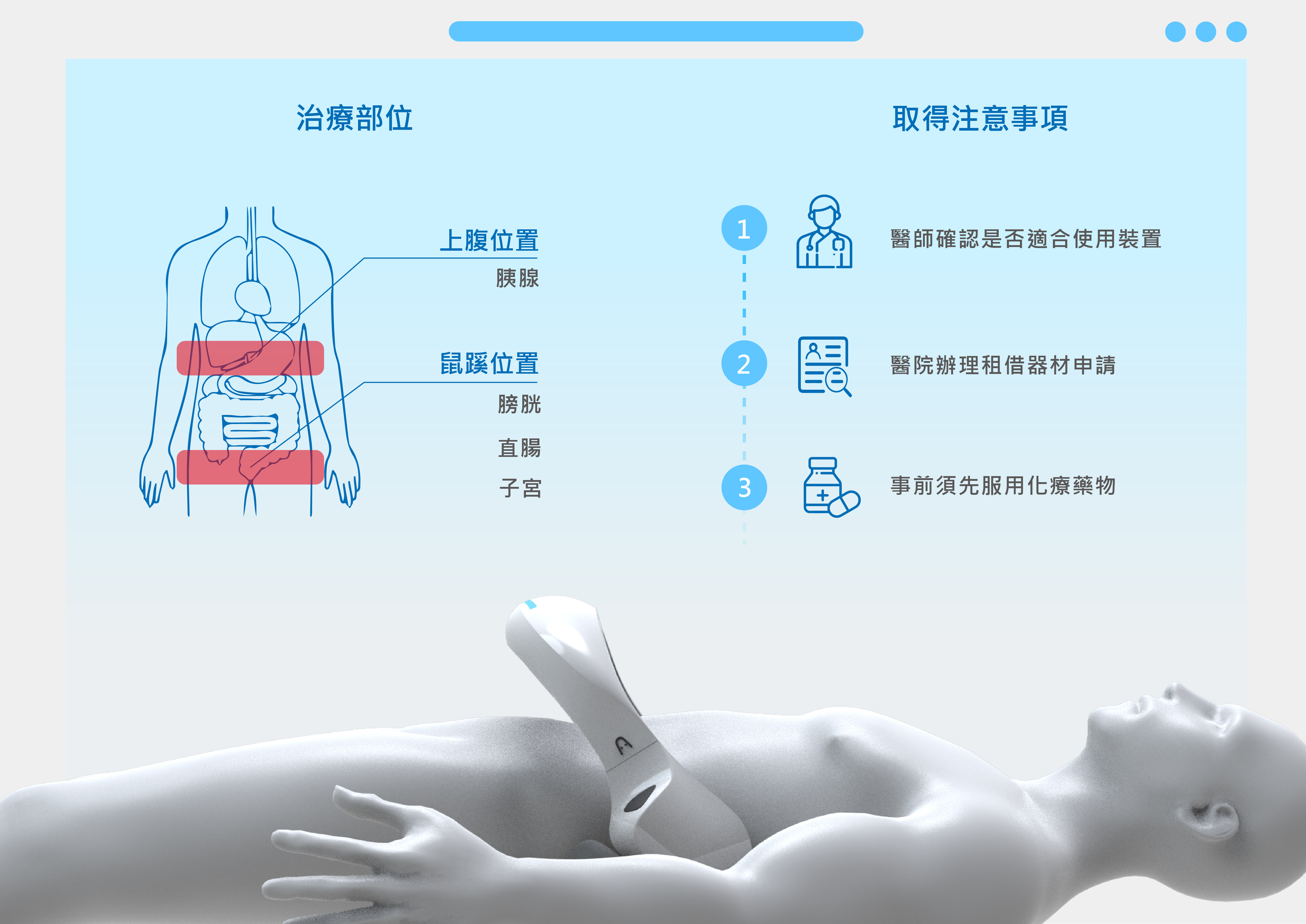 治療部位及取得方式