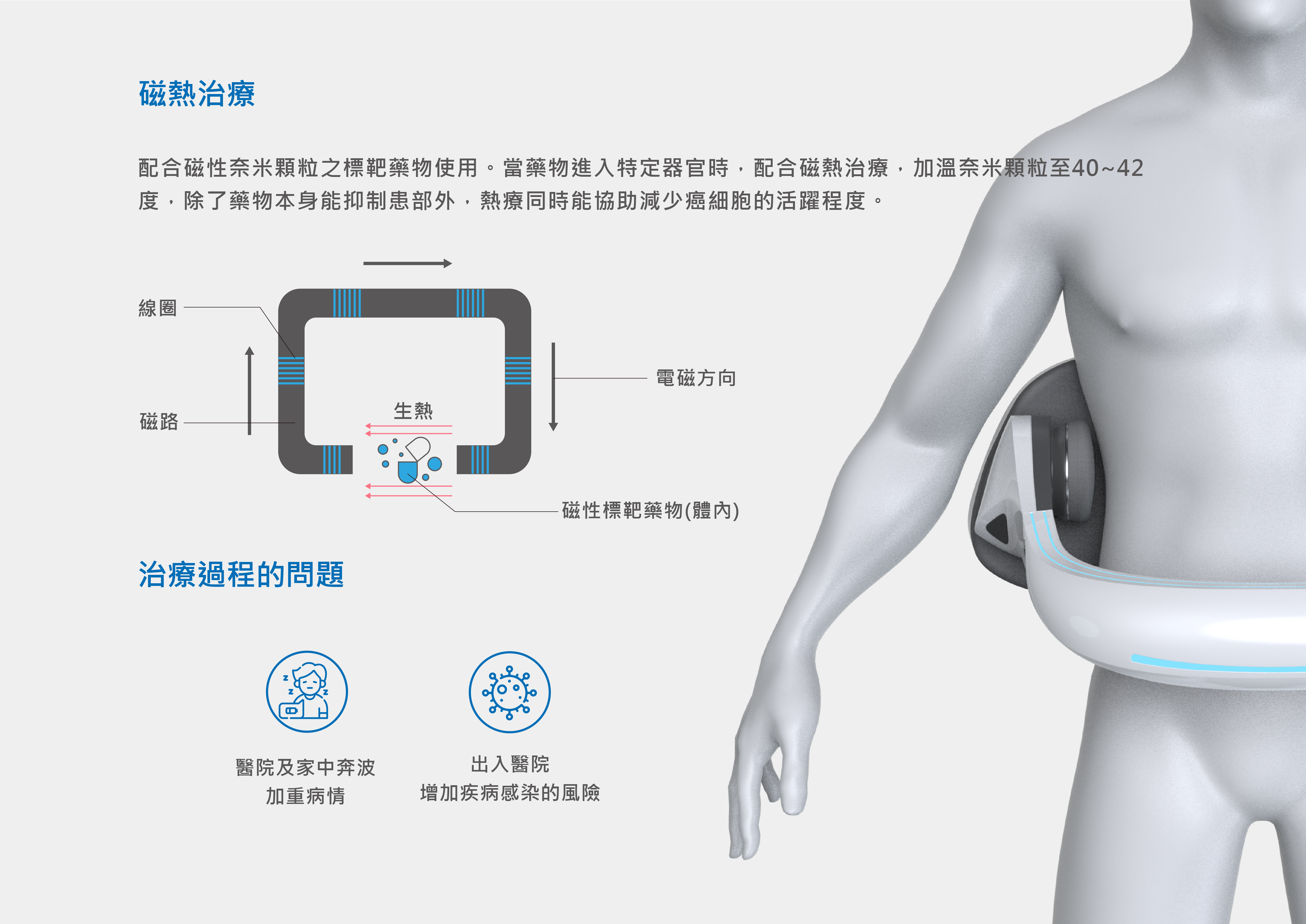 熱治療需要在醫院進行，但會造成諸多不便