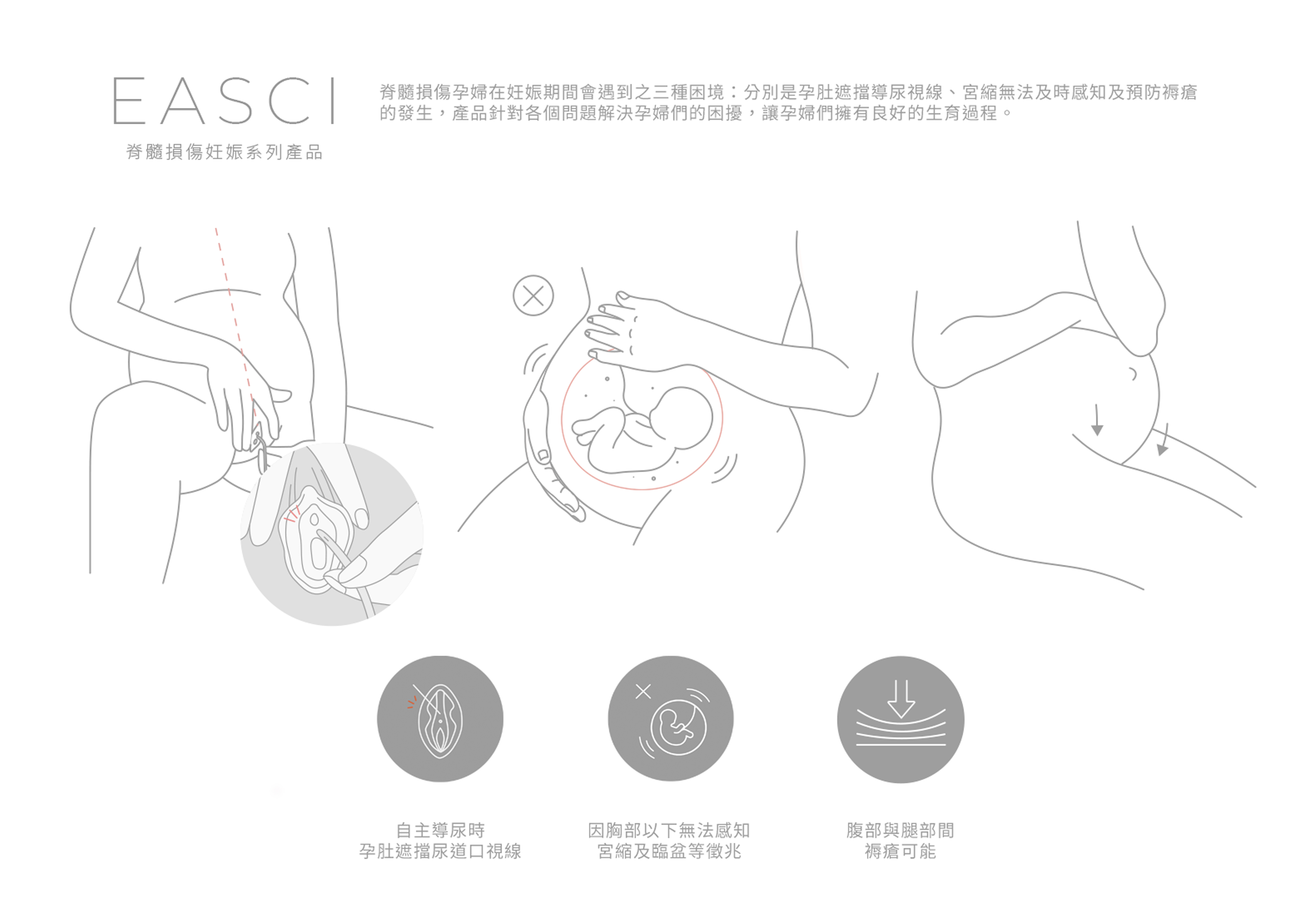 EASCI 脊髓損傷妊娠系列產品